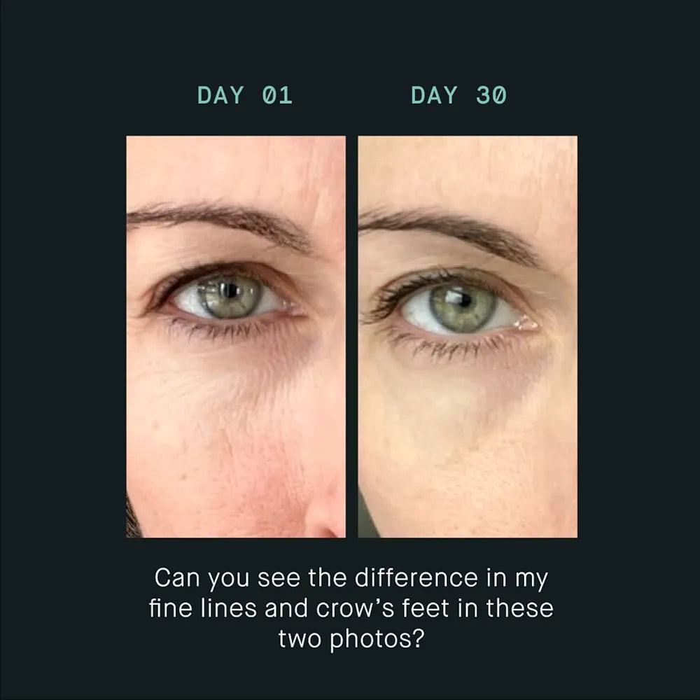 OneSkin EYE OS-01 Peptide Topical Supplement: Fragrance-Free Anti-Aging Eye Cream for Sensitive Skin