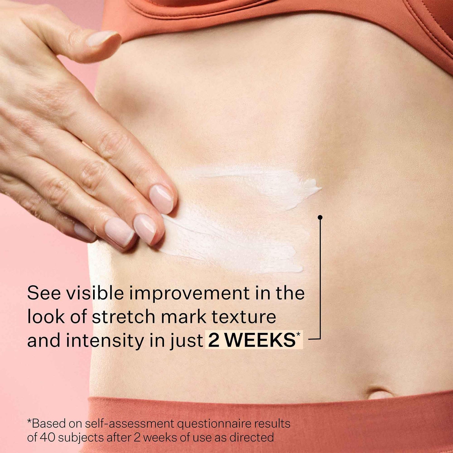 StriVectin SD Advanced Plus Intensive Moisturizer for Wrinkles and Stretchmarks, For Face and Body, Collagen Boosting with Peptides and Hyaluronic Acid