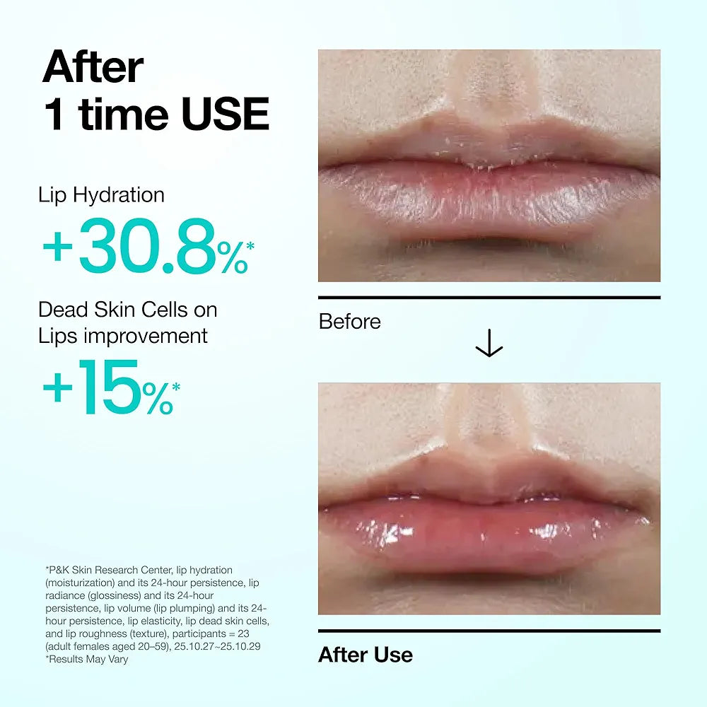 Anua PDRN Hydrating Lip Serum with Salmon DNA, Hyaluronic Acid & Collagen - 0.33 fl.oz