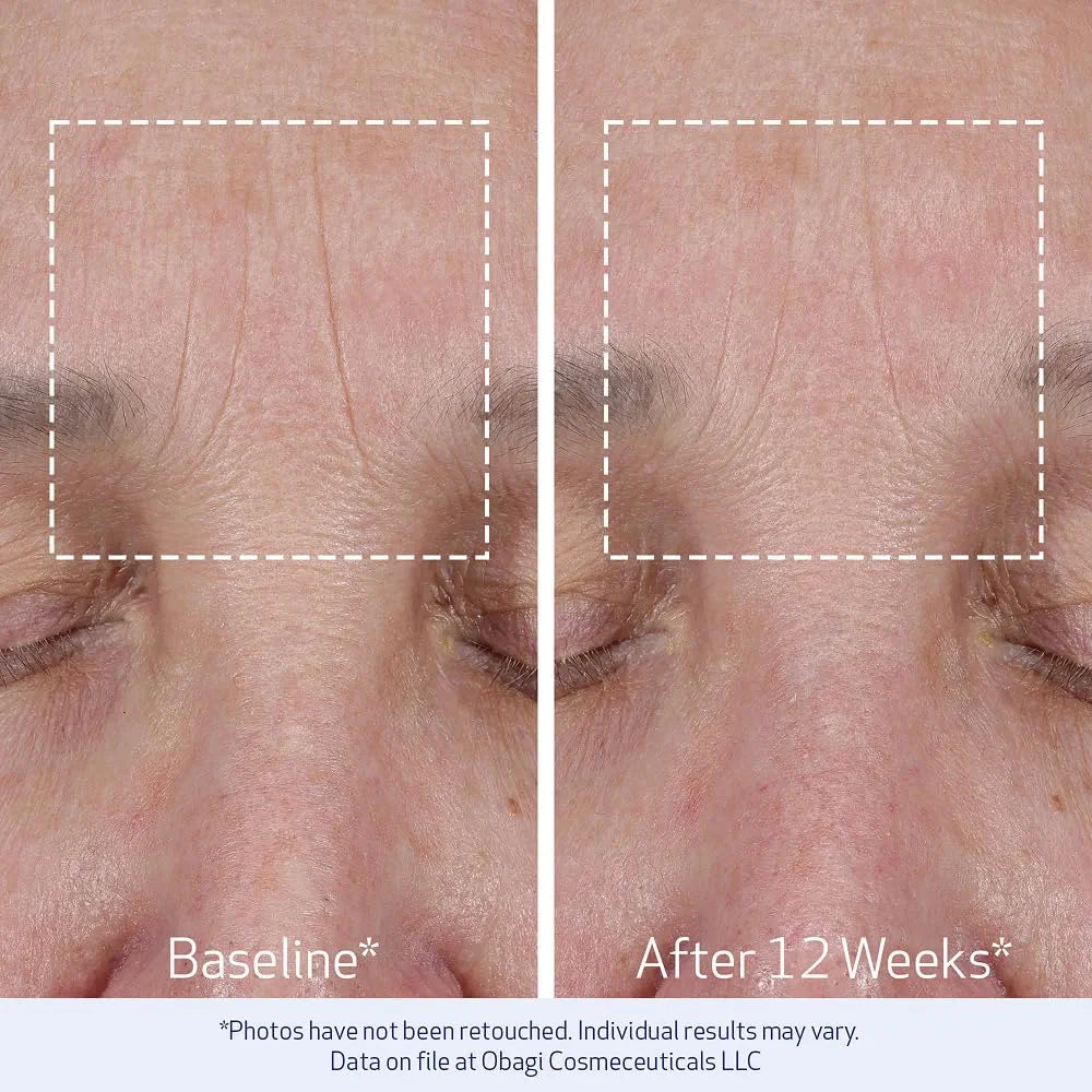 Obagi ELASTIderm Lift Up & Sculpt Facial Moisturizer - 1.7 oz Anti-Aging Peptide Cream for Firming and Wrinkle Reduction