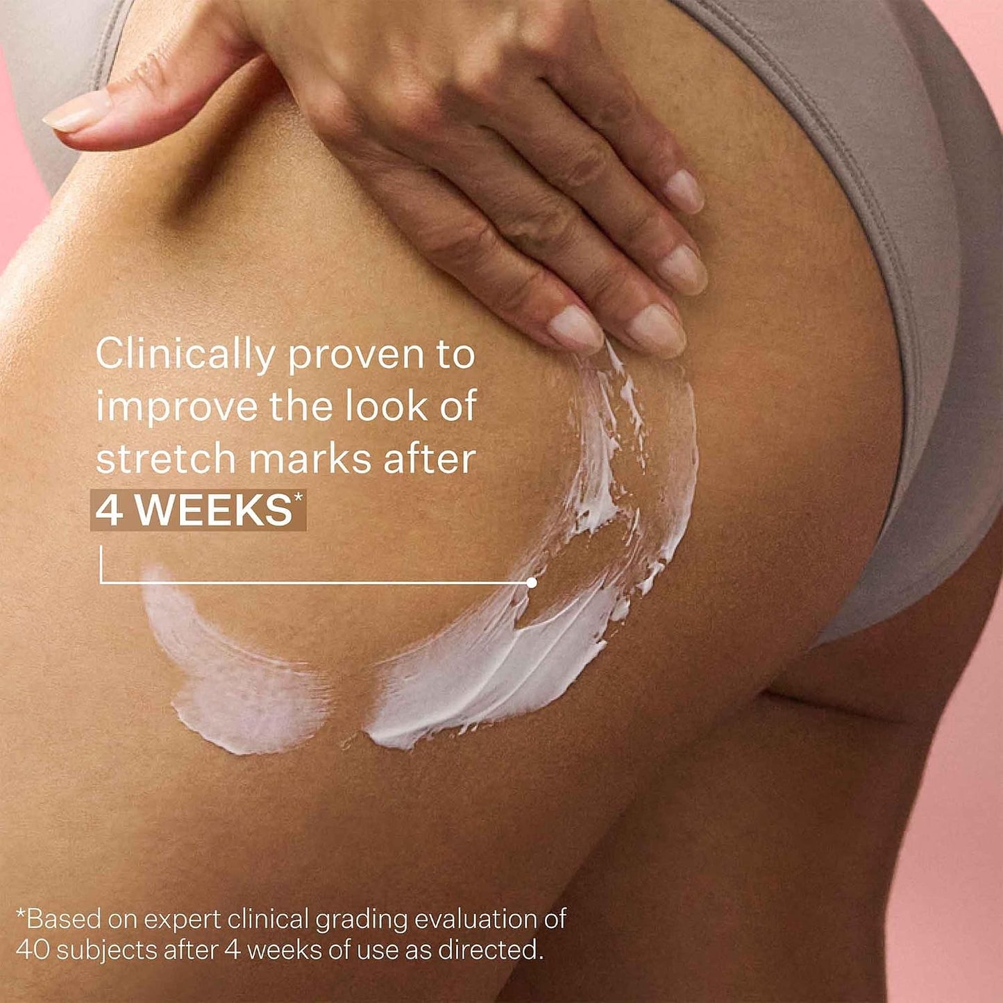 StriVectin SD Advanced Plus Intensive Moisturizer for Wrinkles and Stretchmarks, For Face and Body, Collagen Boosting with Peptides and Hyaluronic Acid