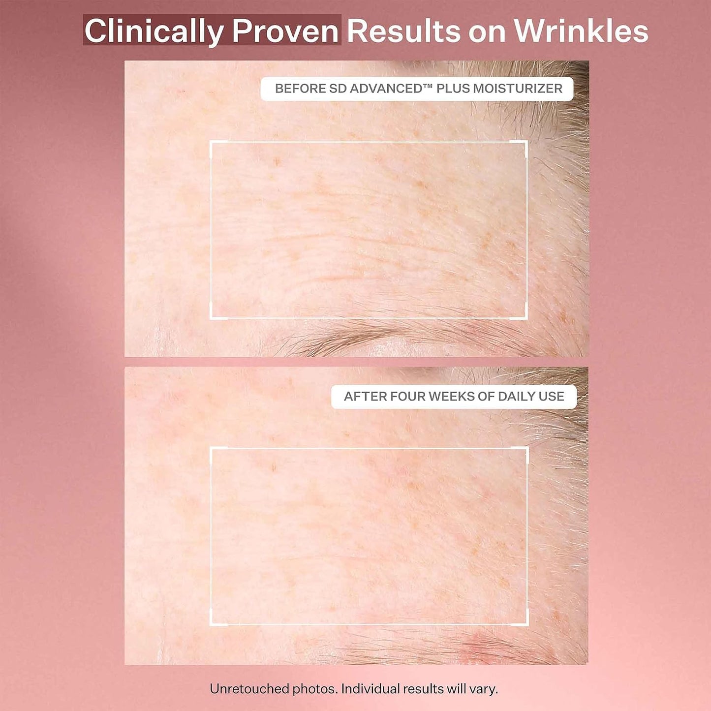 StriVectin SD Advanced Plus Intensive Moisturizer for Wrinkles and Stretchmarks, For Face and Body, Collagen Boosting with Peptides and Hyaluronic Acid