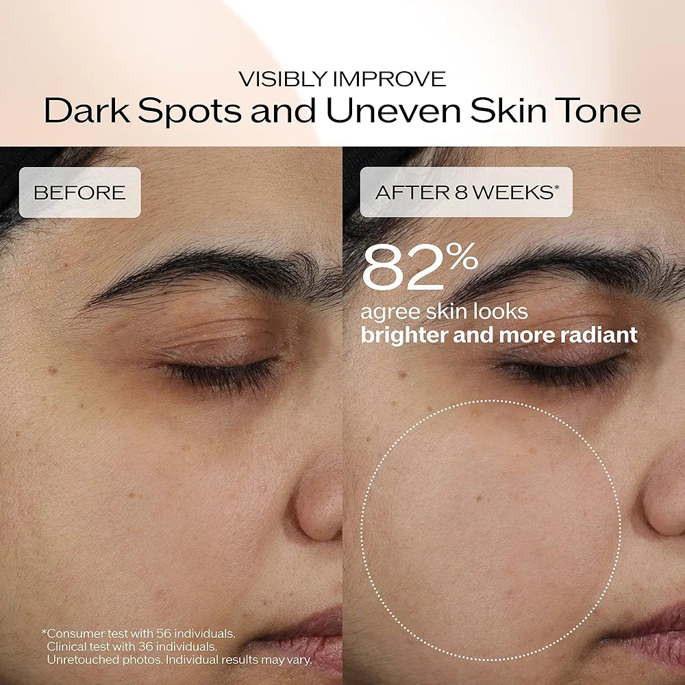 Shiseido Benefiance Brightening and Wrinkle Smoothing Cream - 50 mL - Moisturizer Visibly Improves Dark Spots & Wrinkles with Plant-Based Retinol - 24HR Hydration - Non-Comedogenic, All Skin Types