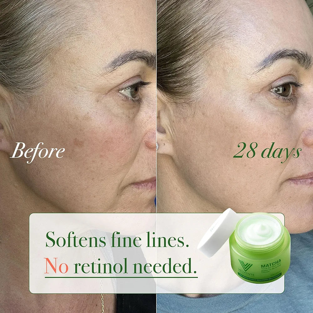 Matcha Anti Aging Face Cream Rose PDRN, Korean Hydrating Firming Facial Moisturizer to Reduce Wrinkles, Soothing Radiance, Glowy Skin, Day & Night Cream for All Skin Types,3.53 oz