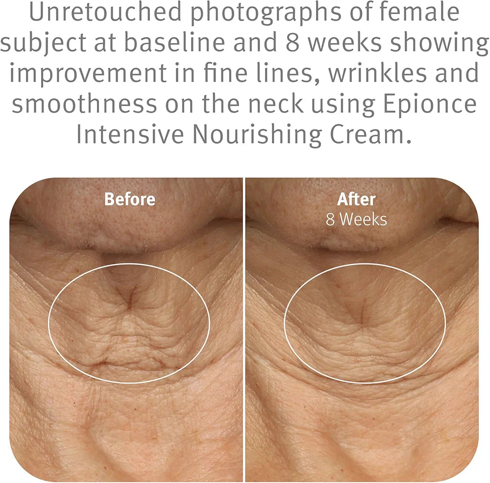 Epionce Intensive Nourishing Cream – Rich Anti-Aging Moisturizer for Face, Neck & Décolletage | Ceramides, Glycerin & Squalene | Targets Fine Lines, Dark Spots & Dryness | Dermatologist Skincare
