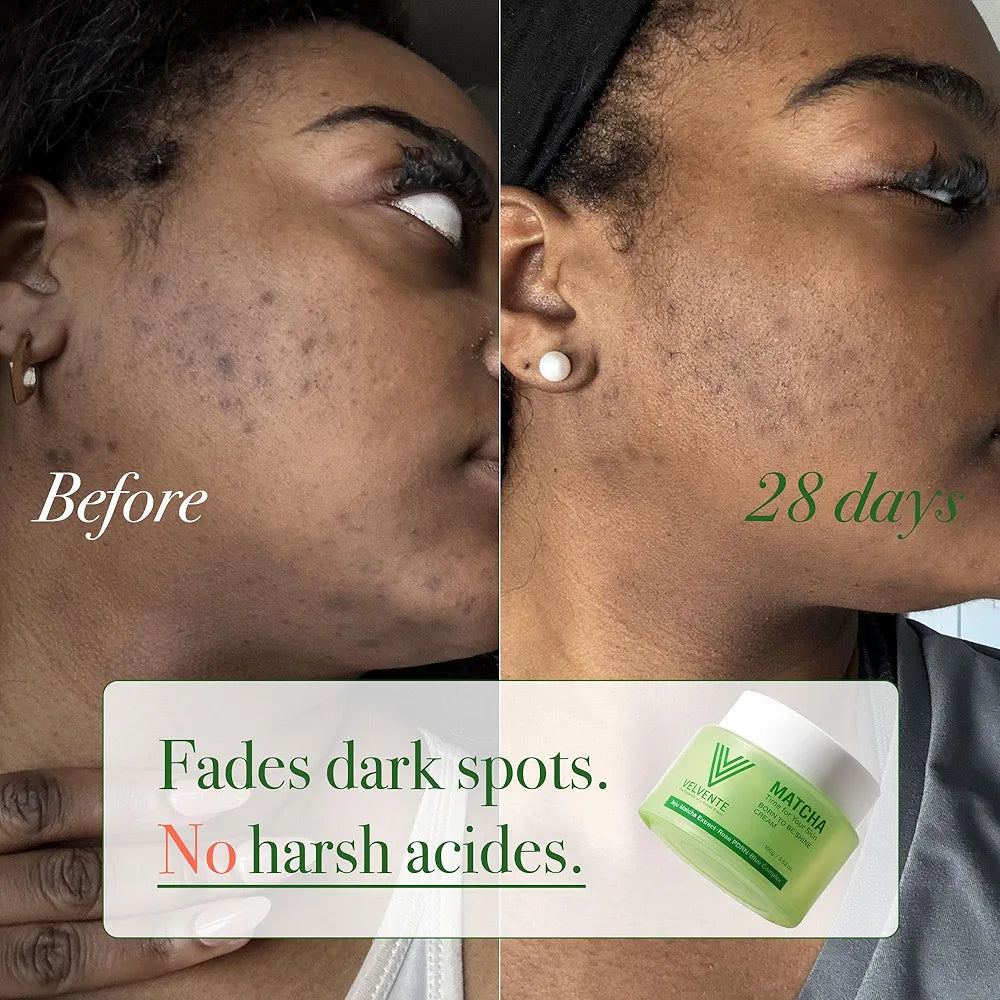 Matcha Anti Aging Face Cream Rose PDRN, Korean Hydrating Firming Facial Moisturizer to Reduce Wrinkles, Soothing Radiance, Glowy Skin, Day & Night Cream for All Skin Types,3.53 oz
