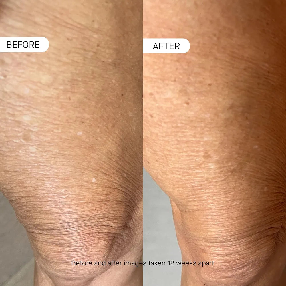 OneSkin BODY OS-01 Peptide Topical Supplement & Skin Longevity Age Reversal Moisturizer | Safe for Sensitive Skin, Fragrance-Free, 250 mL / 8.45 oz